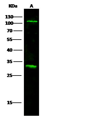 IL17RA/CD217 Monoclonal Antibody (AN200111P)