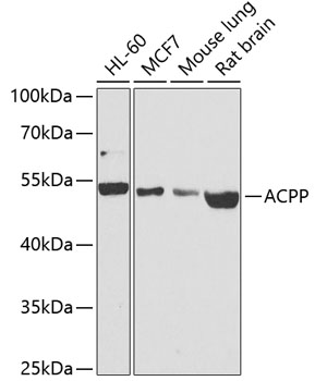 ACPP Polyclonal Antibody (E-AB-60512)