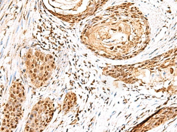 ELF3 Polyclonal Antibody (E-AB-19002)