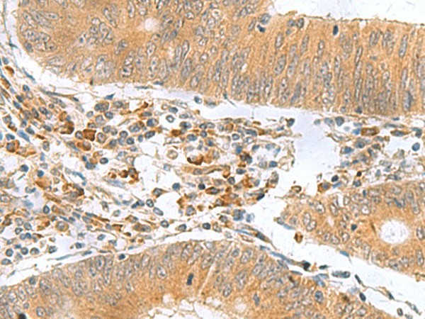 MYDGF Polyclonal Antibody (E-AB-53061)