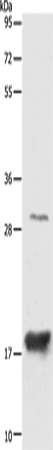 AGR2 Polyclonal Antibody (E-AB-10036)
