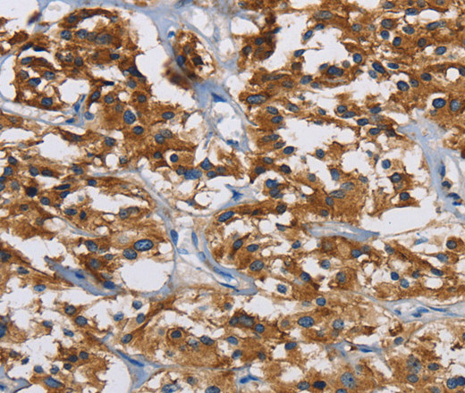 IGF2R Polyclonal Antibody (E-AB-16507)