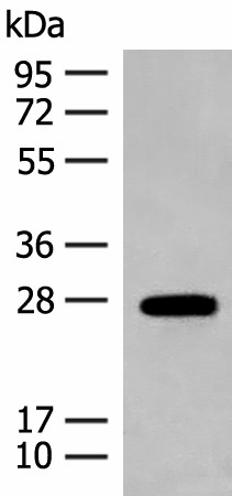 GUCA1B Polyclonal Antibody (E-AB-17991)