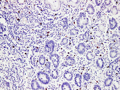 MCT Monoclonal Antibody (ELAB6641-M)