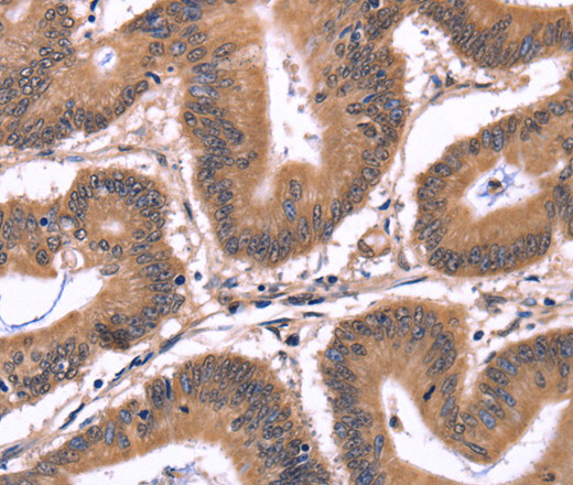 CRK Polyclonal Antibody (E-AB-14896)