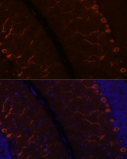 KAL1 Polyclonal Antibody (E-AB-66792)