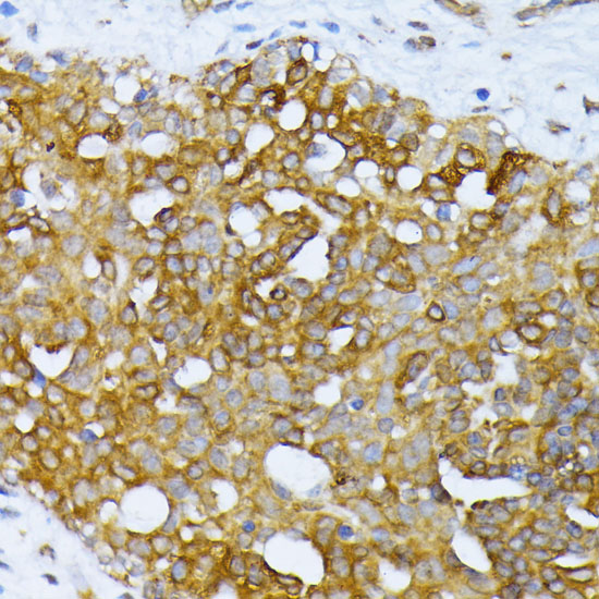 ATG7 Polyclonal Antibody (E-AB-60098)
