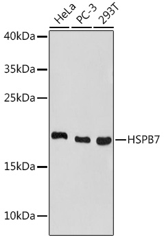 HSPB7 Polyclonal Antibody (E-AB-92051)