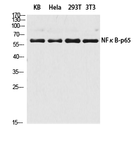 NFκB-p65 Polyclonal Antibody (E-AB-32233)