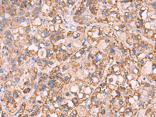 KCNN1 Polyclonal Antibody (E-AB-52082)