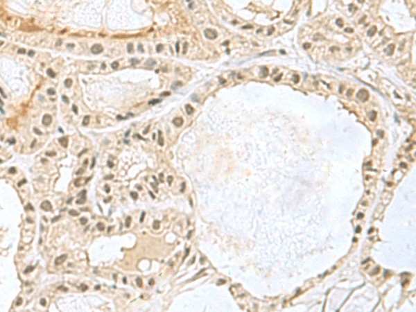 KDM3B Polyclonal Antibody (E-AB-18178)