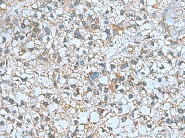 CNTN4 Polyclonal Antibody (E-AB-53008)