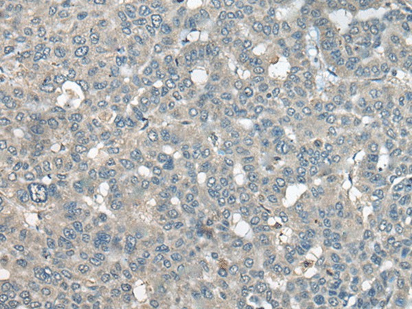 UCN3 Polyclonal Antibody (E-AB-17833)