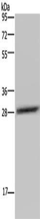 CEBPD Polyclonal Antibody (E-AB-12318)