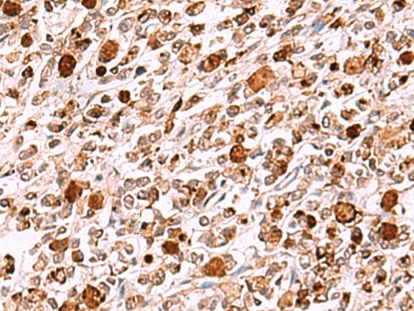 INO80 Polyclonal Antibody (E-AB-18113)