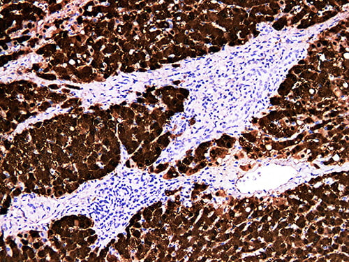 Arginase-1 Monoclonal Antibody (ELAB6685-M)