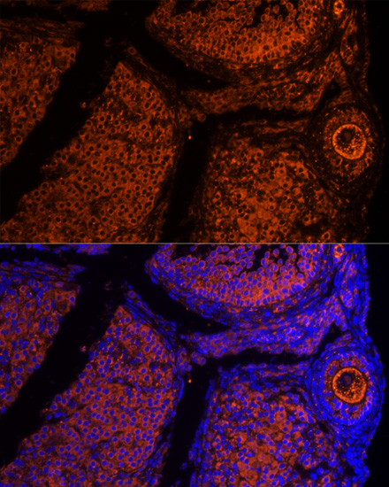 ZP2 Polyclonal Antibody (E-AB-63275)