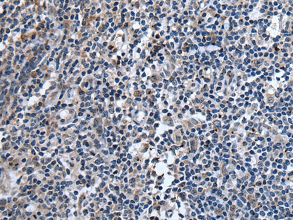 TNFSF18 Polyclonal Antibody (E-AB-53342)