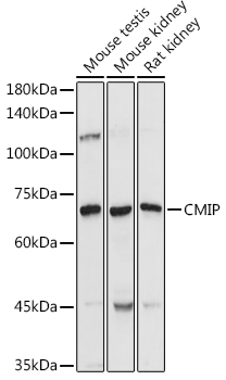 CMIP Polyclonal Antibody (E-AB-92262)