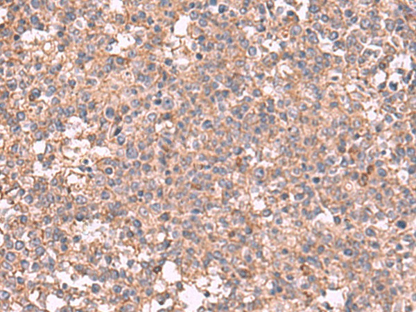 MAPK8IP3 Polyclonal Antibody (E-AB-18142)