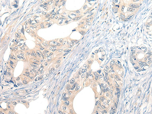 NOG Polyclonal Antibody (E-AB-17854)