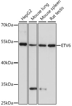 ETV6 Polyclonal Antibody (E-AB-93139)