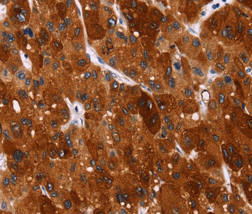 HSPB6 Polyclonal Antibody (E-AB-16499)