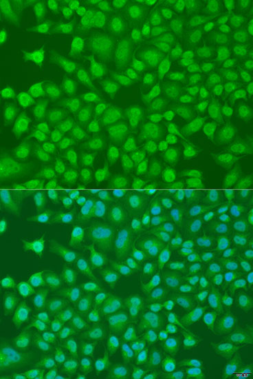 PLEKHA1 Polyclonal Antibody (E-AB-66648)