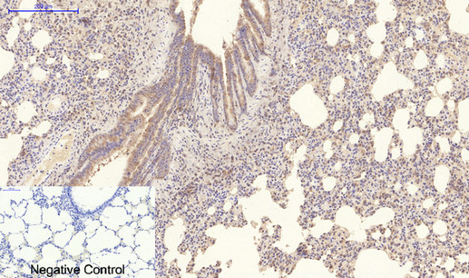 COL4A1 Monoclonal Antibody (E-AB-22150)
