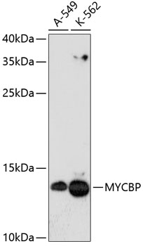 MYCBP Polyclonal Antibody (E-AB-65487)