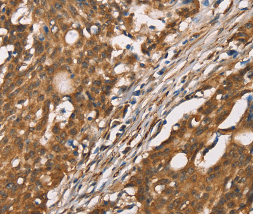 DICER1 Polyclonal Antibody (E-AB-13197)