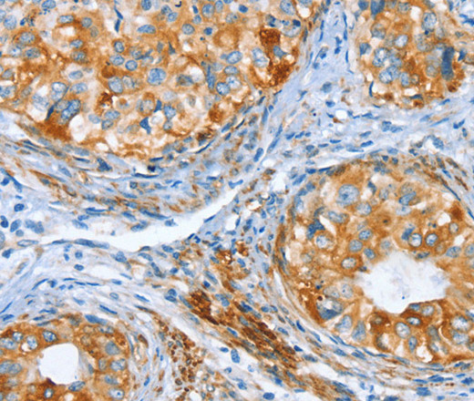 AIP Polyclonal Antibody (E-AB-16169)