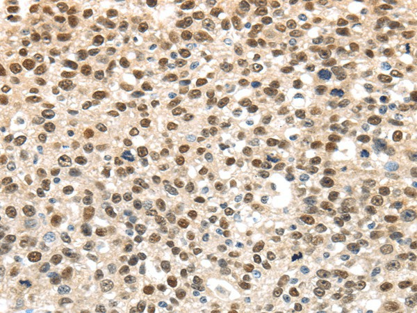 UBA1 Polyclonal Antibody (E-AB-17501)