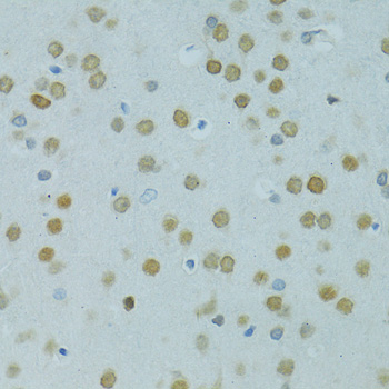 MUS81 Polyclonal Antibody (E-AB-62531)