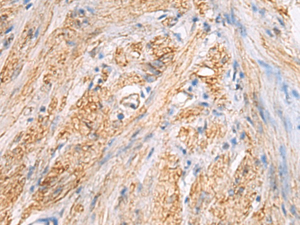TMOD3 Polyclonal Antibody (E-AB-19247)