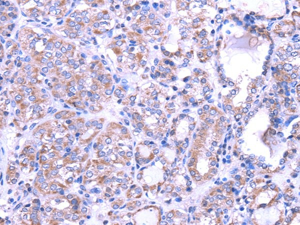 SRPK1 Polyclonal Antibody (E-AB-17037)
