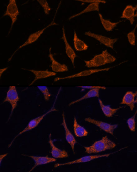 RPE Polyclonal Antibody (E-AB-65107)