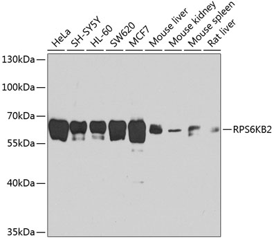 RPS6KB2 Polyclonal Antibody (E-AB-62204)