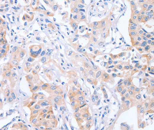 CDCA4 Polyclonal Antibody (E-AB-13140)