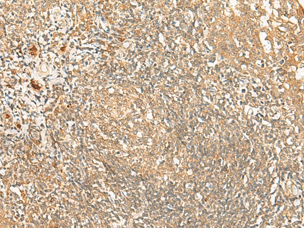 PROKR1 Polyclonal Antibody (E-AB-18047)