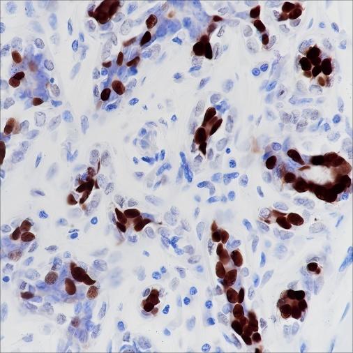 Recombinant Progesterone Receptor Monoclonal Antibody (AN301636L)