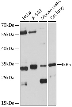IER5 Polyclonal Antibody (E-AB-92057)