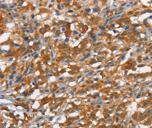 CD168 Polyclonal Antibody (E-AB-12776)