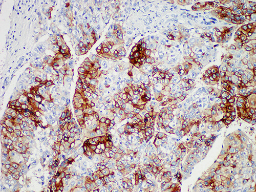 Glypican-3 Monoclonal Antibody (ELAB6929-M)