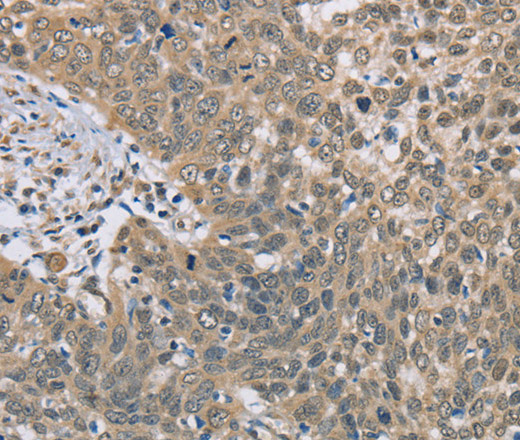 DACH2 Polyclonal Antibody (E-AB-14927)