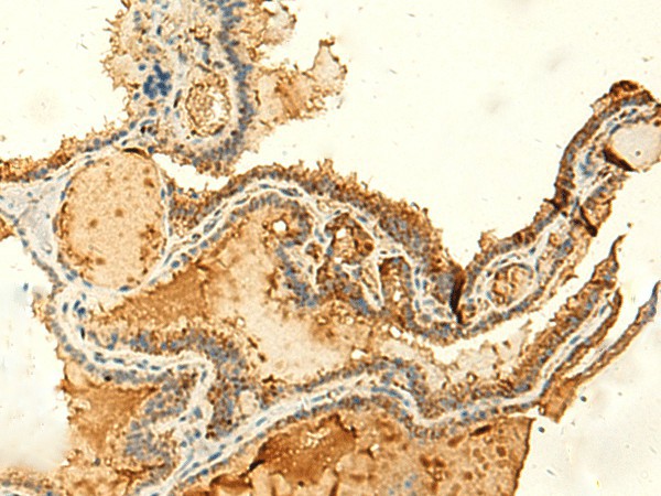 KIAA0513 Polyclonal Antibody (E-AB-52874)