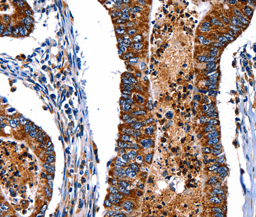 ITGA7 Polyclonal Antibody (E-AB-12521)