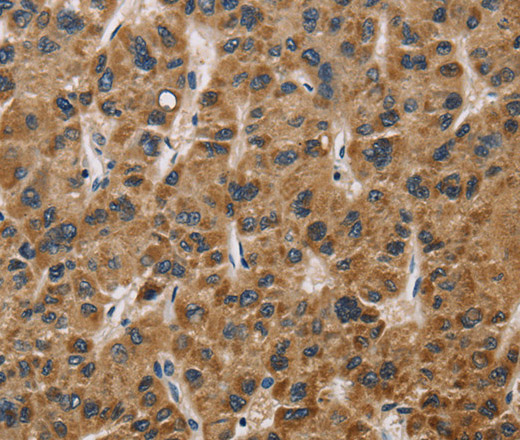 IL19 Polyclonal Antibody (E-AB-13327)
