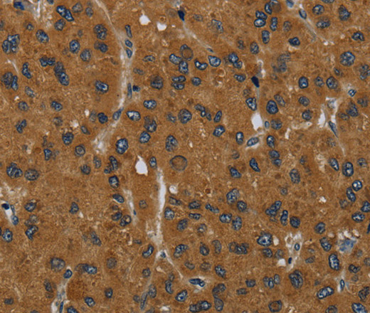 MIER2 Polyclonal Antibody (E-AB-15208)