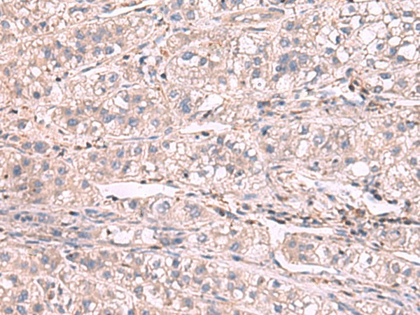 KCNIP1 Polyclonal Antibody (E-AB-18164)